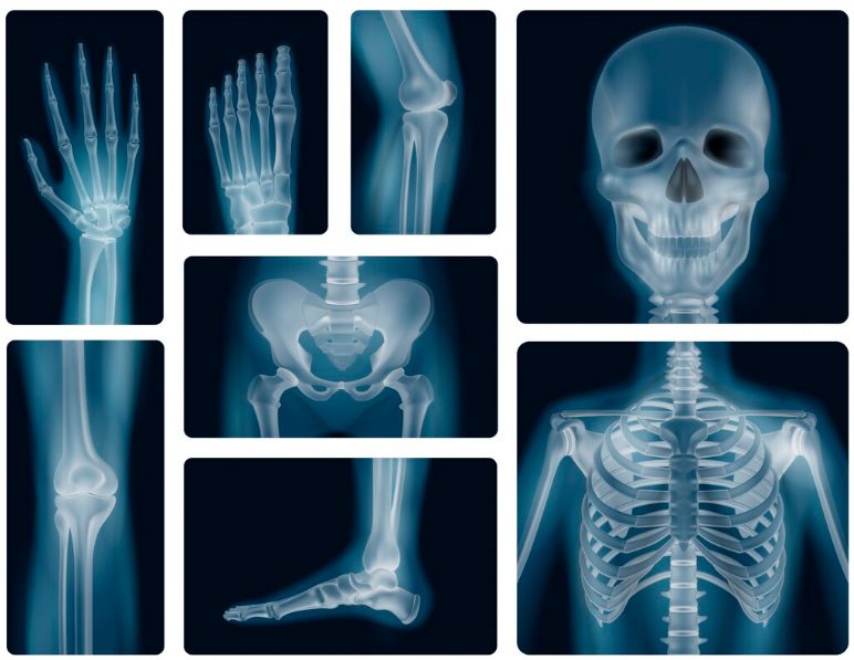 «Криптонит» предупредил о рисках обучения медицинских и банковских ИИ-систем на синтетических данных